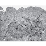 Electron Micrograph of the Apical Part of the Urothelium