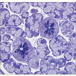 Light Micrograph of Part of a Mixed Salivary Gland