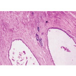 Light Micrograph of an Atrophic Mammary Gland From an Elderly Postmenopausal Woman