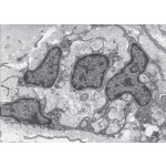 Electron Micrograph of a Growing Tendon During the Adolescent Growth Spurt