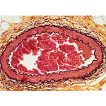 Light Micrograph of an Arteriole In Transverse Section