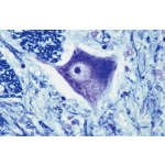 Light Micrograph of Part of the Spinal Cord