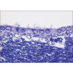 Light Micrograph of Part of the Lateral Ventricle of the Brain