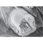 High-resolution Scanning Electron Micrograph of a Myelinated Nerve Fiber Fractured In the Transverse Plane