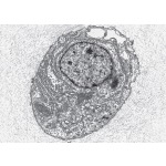 Electron Micrograph  of a Chondrocyte In Hyaline Cartilage of the Trachea