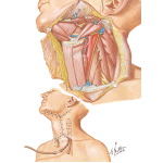 Radical Neck Dissection