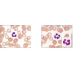 Light Micrographs of Neutrophils In Blood Smears