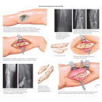 Orthopedics image