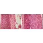 Comparative Light Micrographs of the Wall of the Aorta of a Newborn (Left) and 25-Year-old (Right)