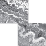Electron Micrographs of Parts of the Aortic Wall at Low (Left) and Medium (Below) Magnification