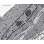 Electron Micrograph of the Wall of an Arteriole
