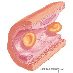 Electron Micrograph of Part of an Arteriole
