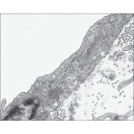 Electron Micrograph of Part of a Vascular Endothelial Cell