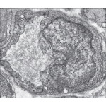 Electron Micrograph of a Skeletal Muscle Tight Capillary Sectioned Transversely