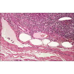 Light Micrograph of a Lymphatic Capillary In Longitudinal  Section