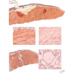 Congenital Anomalies of the Liver