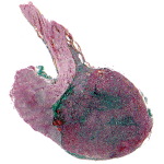 Light Micrograph of the Pituitary In Sagittal Section
