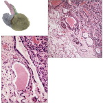Light Micrograph Showing the Three Pituitary Lobes at Low Magnification With Light Micrograph Showing Details of the Junction Between the Anterior and Posterior Lobes