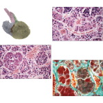 Light Micrograph of the Anterior Lobe Showing Chromophils and Chromophobes and Tinctorial Differences Between Chromophobes and the Two Kinds of Chromophils