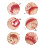 Labeled image
