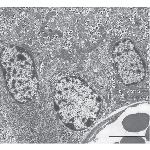 Survey Electron Micrograph of a Mouse Pancreatic Islet