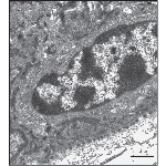 Low-magnification Electron Micrograph of the Dermoepidermal Junction