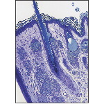 Light Micrograph of Thin Skin of the Eyelid