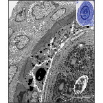 Electron Micrograph of Part of a Hair and Its Follicle In Transverse Section