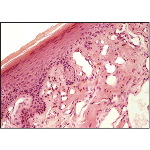 Light Micrograph of the Gingiva