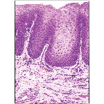 Light Micrograph of the Undersurface of the Tongue