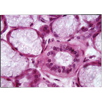 Light Micrograph of Part of a Palatine Gland