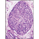 Light Micrograph of a Lobule of a Sublingual Gland