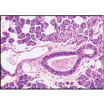 Light Micrograph of a Parotid Gland