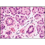 Light Micrograph of a Parotid at Higher Magnification