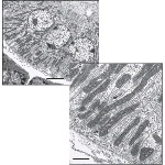 Electron Micrograph of Part of a Striated Duct With Electron Micrograph of the Base of a Striated Duct Cell