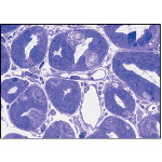 Light Micrograph of Gastric Glands In Transverse Section