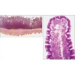 Light Micrograph of the Jejunum at Low Magnification With Light Micrograph of the Tip of a Jejunal Villus In Longitudinal Section