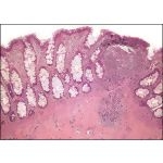 Light Micrograph of the Mucosa of the Colon