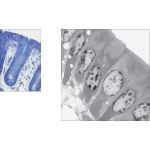 Light Micrograph of the Colonic Mucosa With Electron Micrograph of the Colonic Mucosa