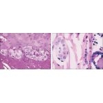 Light Micrographs of the Myenteric (Left) and Submucosal (Right) Plexuses In the Appendix
