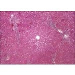 Light Micrograph of a Hepatic Lobule
