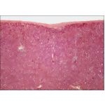 Light Micrograph of the External Aspect of the Liver