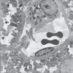 Electron Micrograph of a Hepatic Sinusoid In Transverse Section