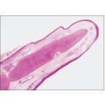 Light Micrograph of the Tip of the Epiglottis at Low Magnification