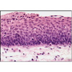 Details of the Epithelial Transition at the Laryngeal Surface of the Epiglottis at High Magnification