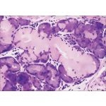Light Micrograph of a Tracheal Seromucous Gland at Higher Magnification