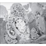 Electron Micrograph Showing Salient Features of Bronchiolar Epithelium