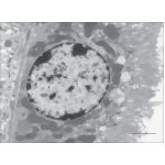 Electron Micrograph of the Wall of a Proximal Tubule