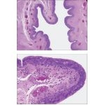 Light Micrograph of the Penile Urethra Showing Key Features at Low Magnification With Light Micrograph of the Mucosa of the Penile Urethra at Higher Magnification