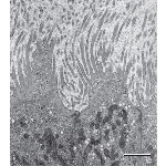 Higher Magnification Electron Micrograph of Apical Surfaces of Principal Cells of the Mouse Ductus Deferens